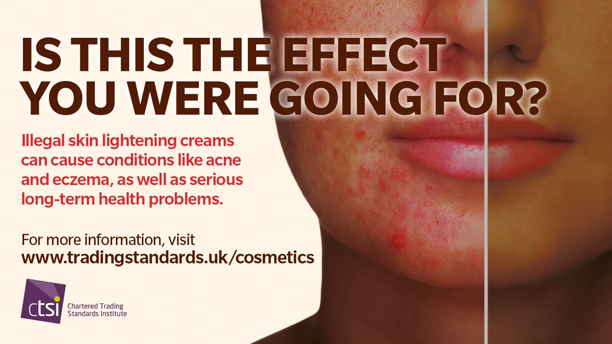 Illegal skin lightening products can cause ongoing issues like acne and eczema. Consumers are advised to speak to their GP if they want to find out more about safe products to use #CostofBeauty ow.ly/lPXf50RuItB