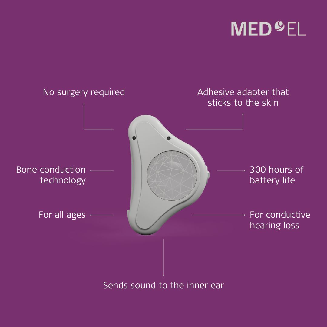 ADHEAR is our unique hearing solution that doesn't require surgery. Discover all its secrets: brnw.ch/21wJoI7 #boneconduction #hearingsolution