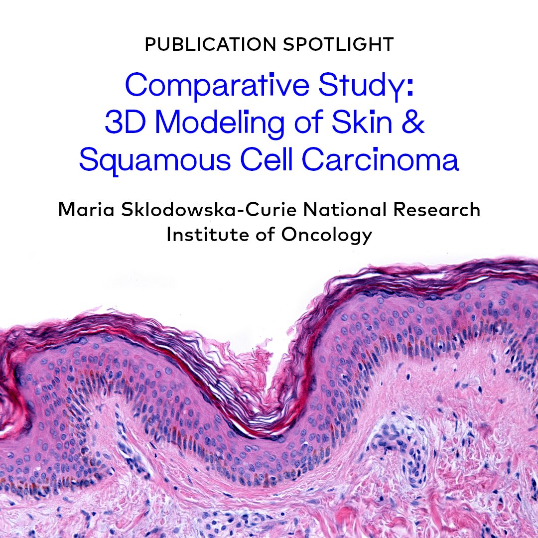 A recent study leveraged the BIO X bioprinter to create sophisticated in vitro models of human skin cancer, which accurately mirrored the complexity of cutaneous squamous cell carcinoma and offered a more representative platform for drug testing. @MSCNRIO iopscience.iop.org/article/10.108…