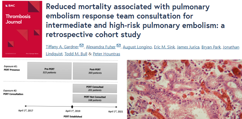 🚨Article Alert🚨
Reduced mortality associated with pulmonary embolism response team consultation for intermediate and high-risk pulmonary embolism: a retrospective cohort study 🫁🩸
#OpenAccess #PulmonaryEmbolism #NationalThrombosisWeek

Read the Article: doi.org/10.1186/s12959…