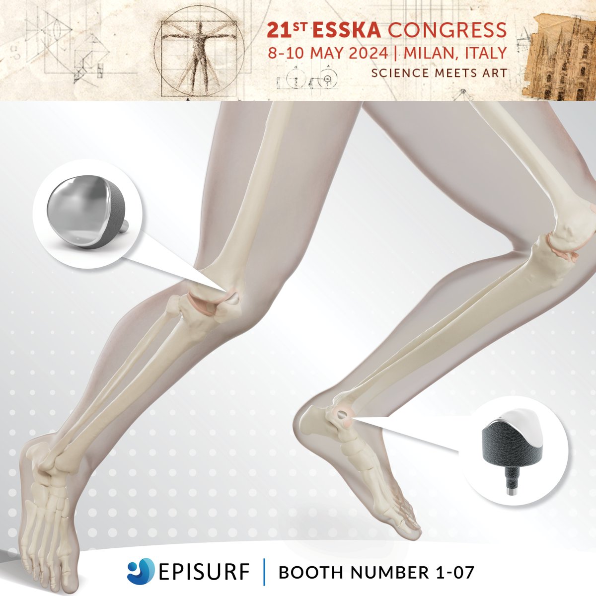 We look forward to a few great days of rewarding discussions and interesting presentations at the ESSKA Congress in Milan, 8-10 May. Hope to see you there! #ESSKA2024 #Episealer #cartilage #resurfacing #orthopaedics #orthotwitter #kneepain #anklepain