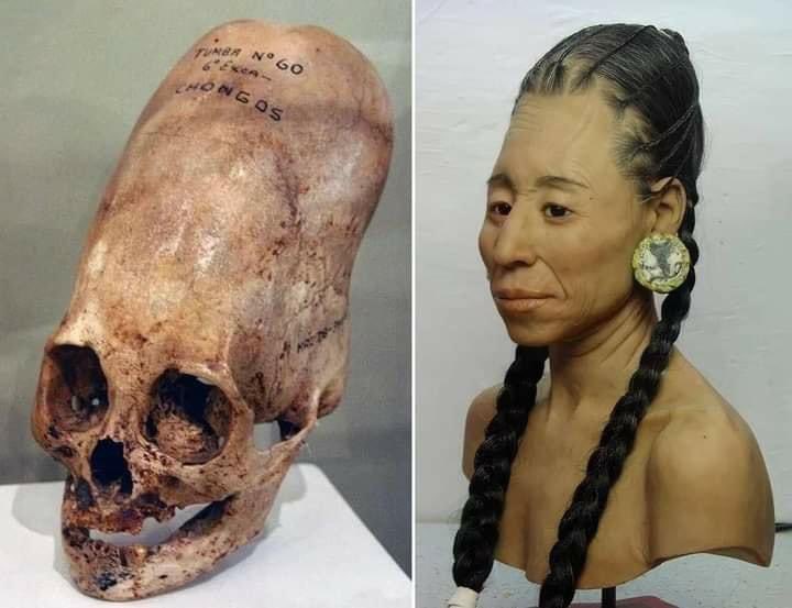 Uma das centenas de crânios alongados que foram descobertos em 1928 na Península de Paracas, no Peru.

A deformação craniana foi praticada pela civilização Paracas (800-100 AC) envolvendo fortemente a cabeça em pano, durante os primeiros anos de vida, a fim de alongar o crânio.