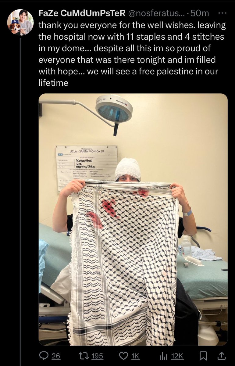 SanaSaeed's tweet photo. This is what those rubber bullets are doing to UCLA students - he was shot in the face. https://t.co/1kfLsdrybp