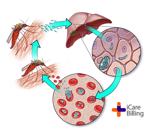 Malaria is a mosquito-borne disease caused by a parasite. People with malaria often experience fever, chills, and flu-like illness. Left untreated, they may develop severe complications and die. #icarebilling, best #medicalbilling solution provider