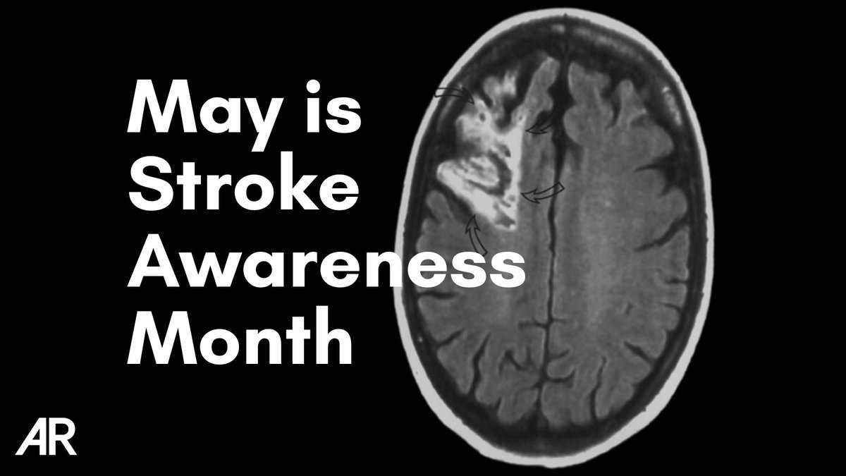 May is #StrokeAwarenessMonth and in recognition of this, we will be posting articles and cases on the topic all month.
