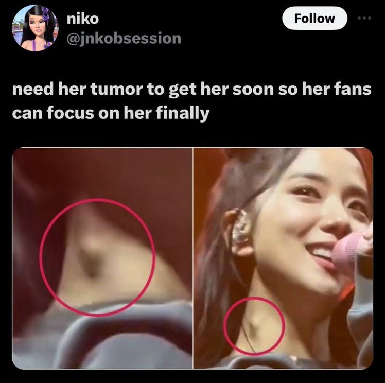 inciting hate on her innocent family members and wishing death on someone over kpop fanwars? 

MASS REPORT! DO NOT ENGAGE! 
MASS REPORT! DO NOT ENGAGE! 

x.com/jnkobsession