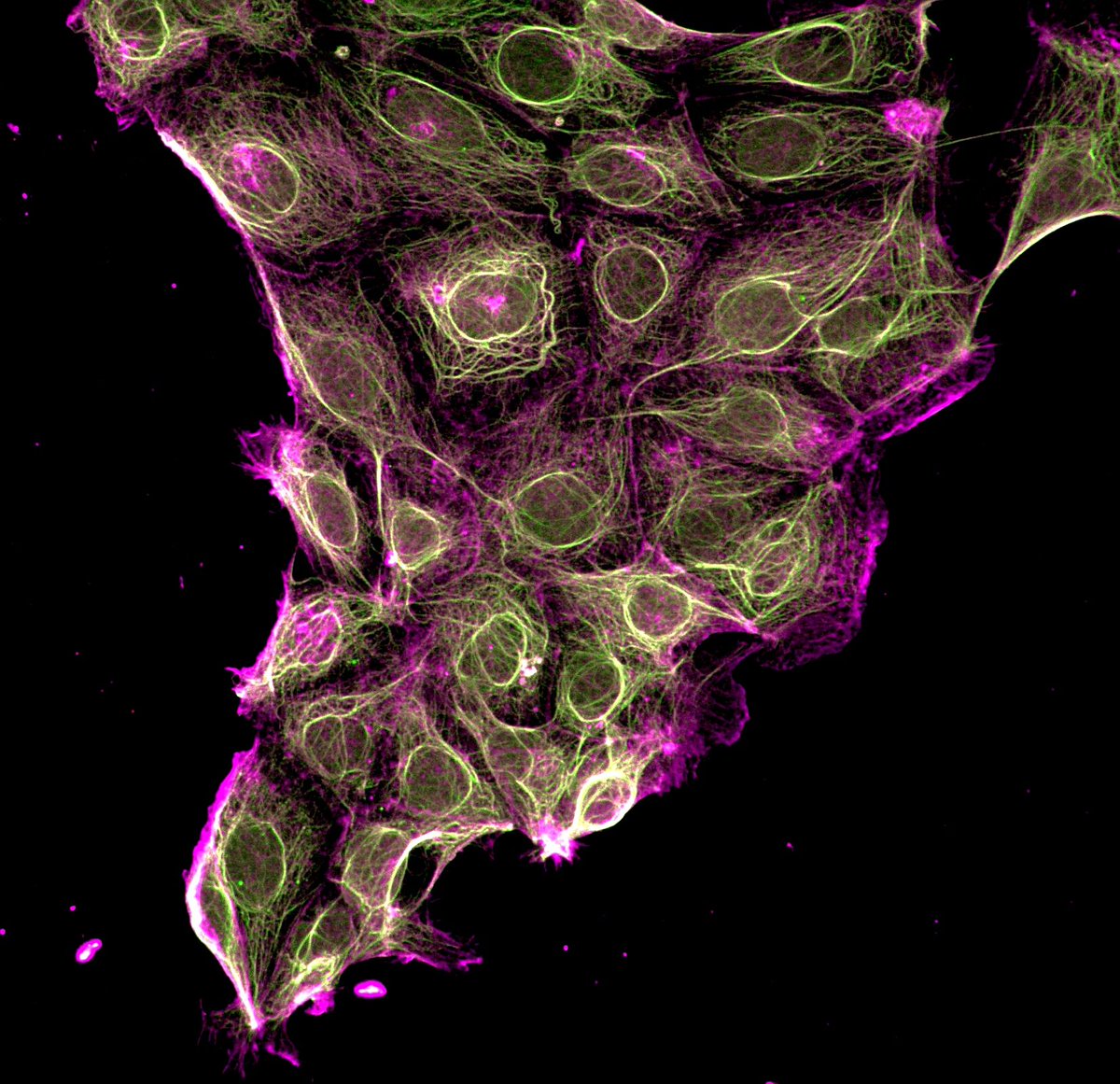 Failing an immunofluorescence assay can sometimes be both frustrating and fascinating... You get no data out of it, but you definitely get great wallpapers for your desktop 🤩
(microtubules or actin, I don't know - but the signal definitely shouldn't be there! )