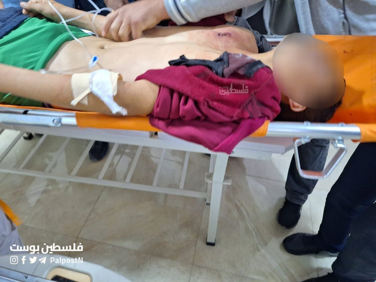 A Palestinian child has been rushed to the hospital in critical condition after Israeli occupation forces shot him in the chest during the ongoing raid in the town of Qusra, south of Nablus.