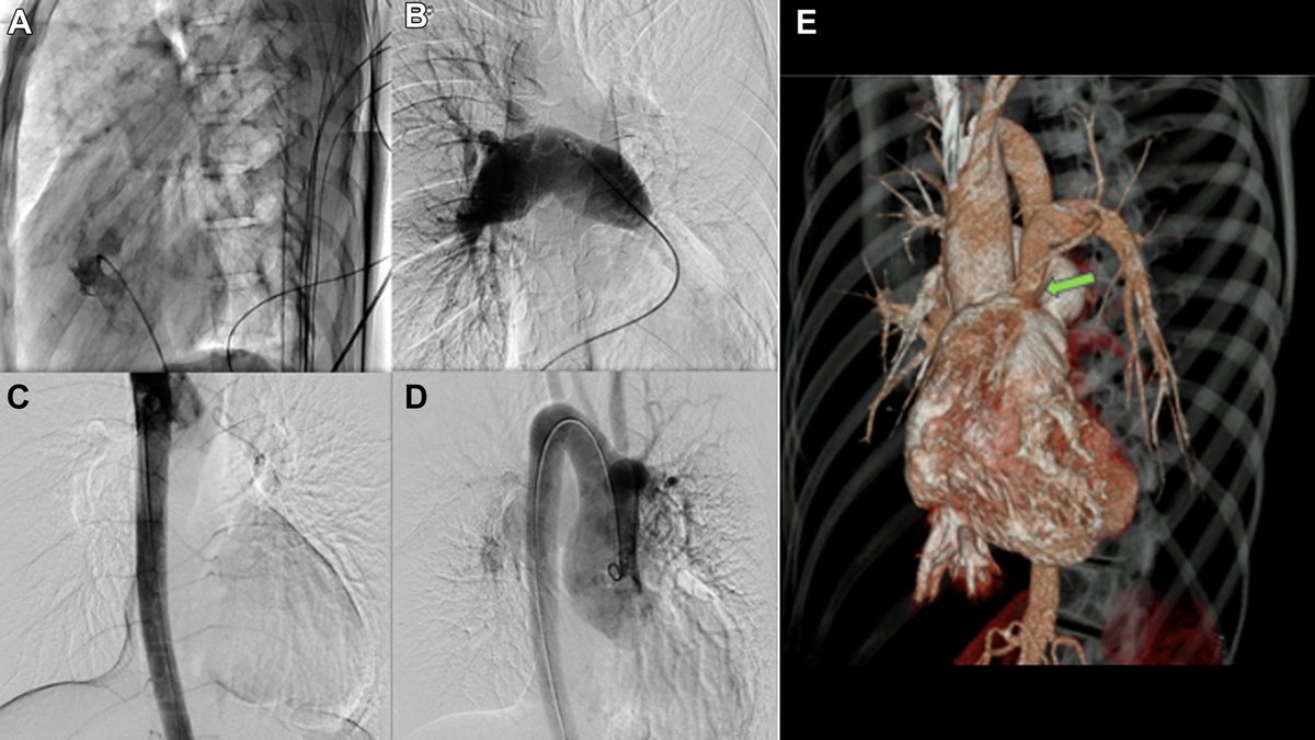 JACC Journals tweet media