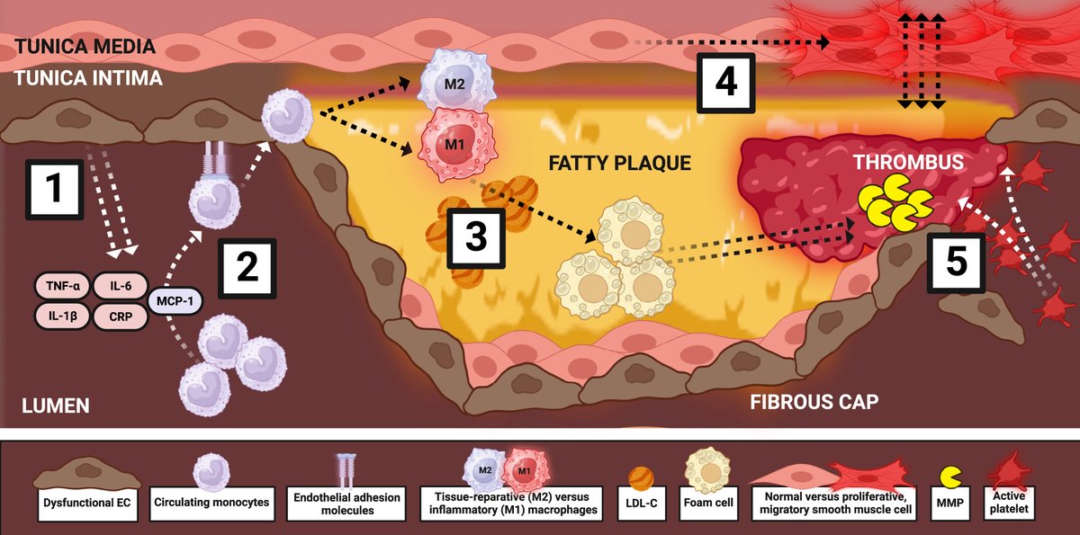 New Review by Park et al. @uoftmedicine provides comprehensive and in-depth mechanistic insight into the anti-atherosclerotic properties of GLP-1RAs demonstrated across large outcome trials ow.ly/xgME50RuTwB #atherosclerosis #inflammation