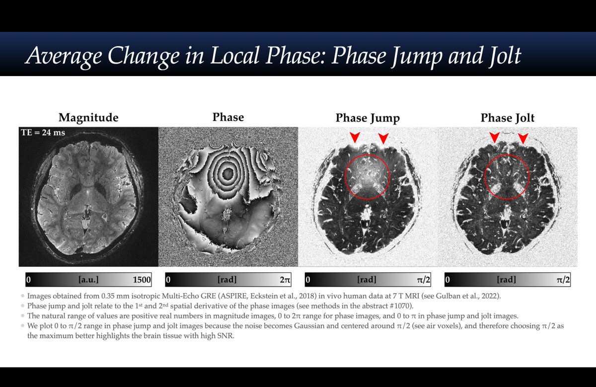 Another ISMRM 2024 power pitch ( #1070 ): 

● “Phase jolt: Second spatial derivative of phase images is …” 
● Image Reconstruction
● Wed 08 May | 15:45 | PC: 6
● Watch: youtu.be/xmnKw_P97jU?si…

@DMRIvanov will cover it for me. Unfortunately I will not be there in person.