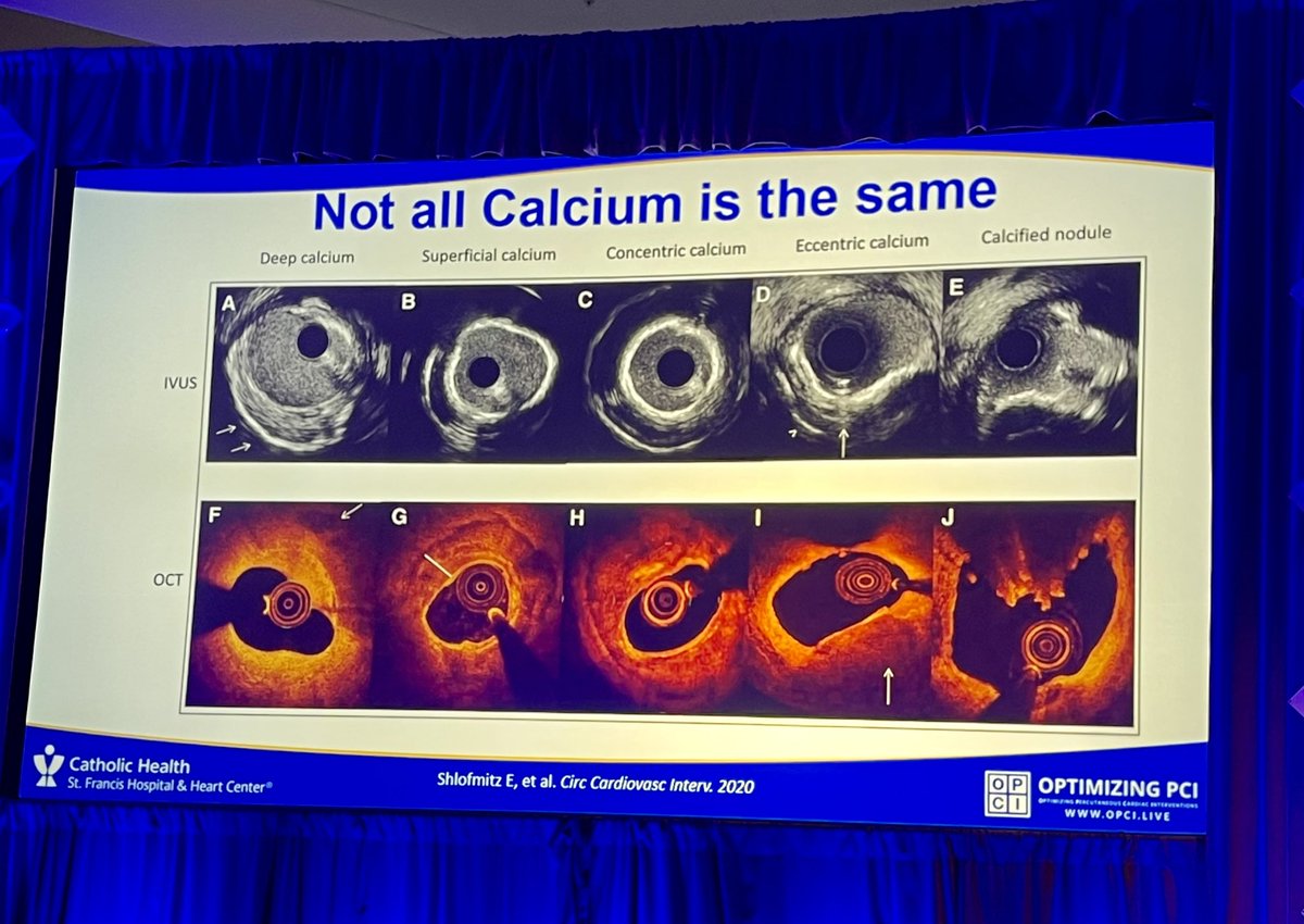 @SCAI had begun with a great talk about the role of intravascular imaging #IVUS and #OCT by @ESHLOF. Not all calcific lesions are created equal and the should be treated accordingly. Calcification depth is a relevant variable and OCT is superior than IVUS on that regard.
