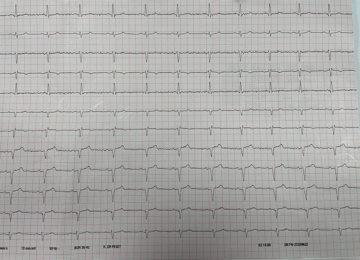 Cardiología Peset tweet media