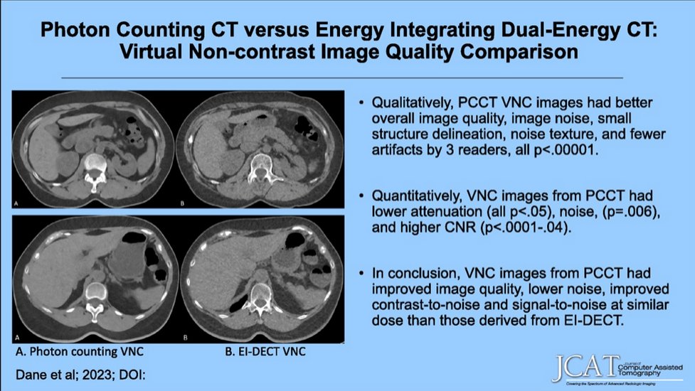 'New @JCATonline 'Photon-Counting Computed Tomography Versus Energy-Integrating Dual-Energy Computed Tomography: Virtual Noncontrast Image Quality Comparison' MarApr'24Issue bit.ly/3xWjf76 Au: Bari Dane et al. @NYUimaging, #radiology #CT #photoncounting