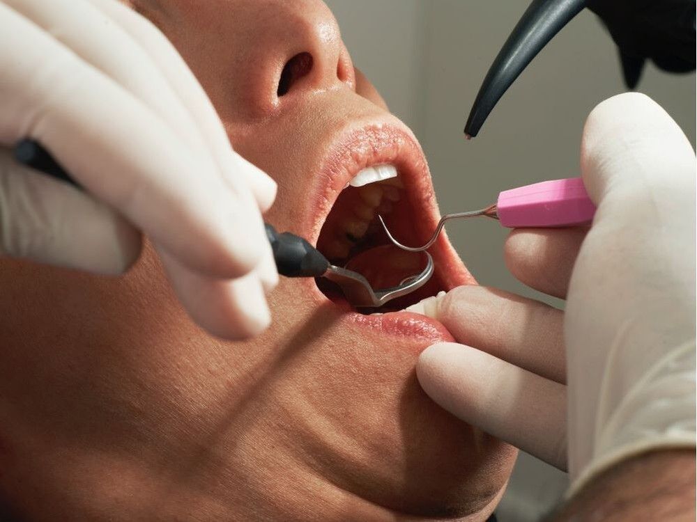 Canadian Dental Care Plan: Who's eligible and what's covered? vancouversun.com/news/local-new…