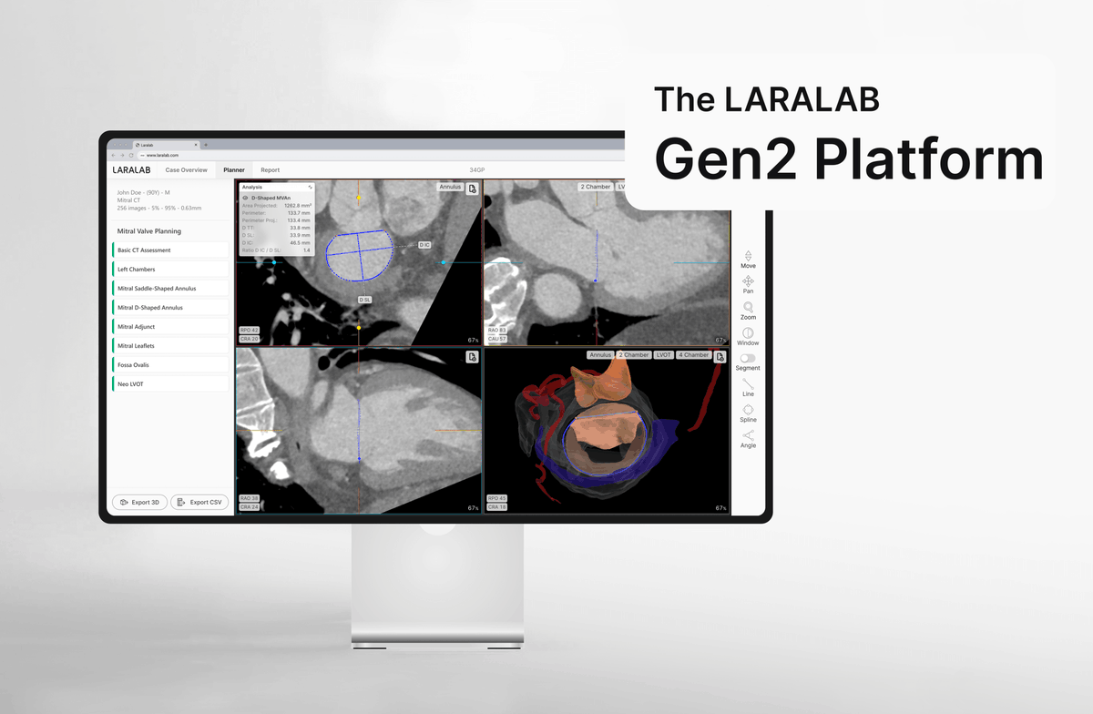 🚀 We're thrilled to announce the launch of the LARALAB Gen2 Platform! Read the press release here: lnkd.in/dXAvbg8P 🚀

Experience the next level and sign up for a free trial → lnkd.in/dAUYD9wg

#Cardiology #MedicalImaging #AI #LARALABGen2 #HealthTech