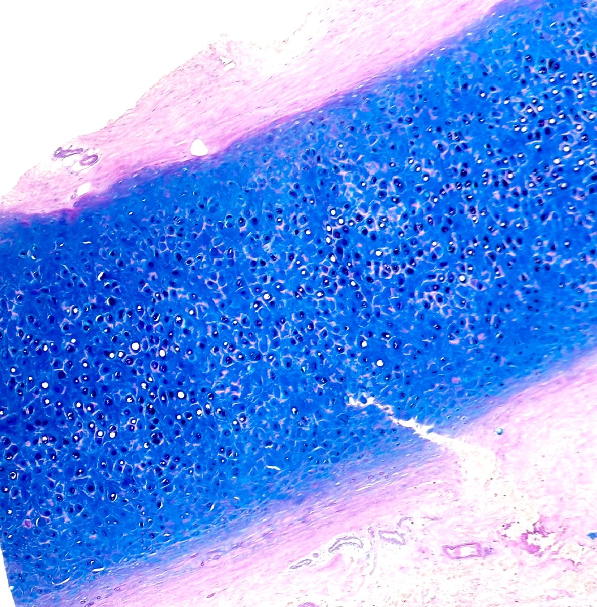 ⚡️⚡️Alcian Blue ⚡️⚡️#Cartilage
#pathology 
#histology
 🤓