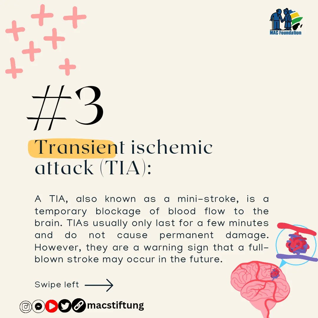 macstiftung's tweet photo. Stroke 101: What It Is and the Types You Should Be Aware Of
#stroke #strokeawareness #strokesurvivor #health #brainhero #knowthesigns #ischemicstroke #hemorrhagicstroke #transient #tia #ministroke #weakness #strokethriver #macstiftung #amici23 #FreePalestine #UCLA #Eurovision https://t.co/Ru8VAz5OKH