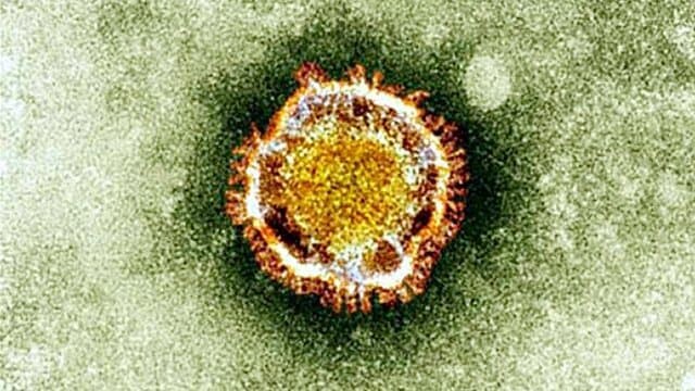 Un cas confirmé de fièvre de Lassa en région parisienne: qu'est-ce que ce virus venu d'Afrique de l'Ouest?
l.bfmtv.com/nNes
