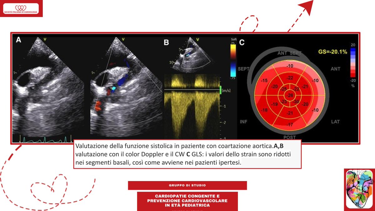 SIC_CARDIOLOGIA tweet picture