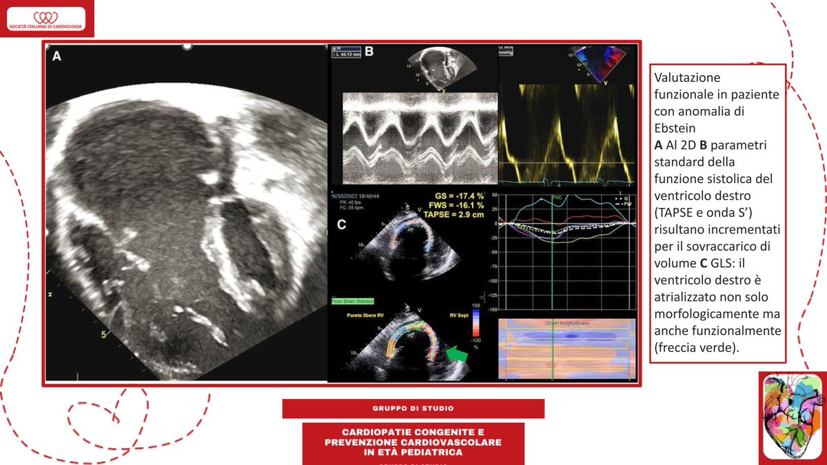 SIC_CARDIOLOGIA tweet picture