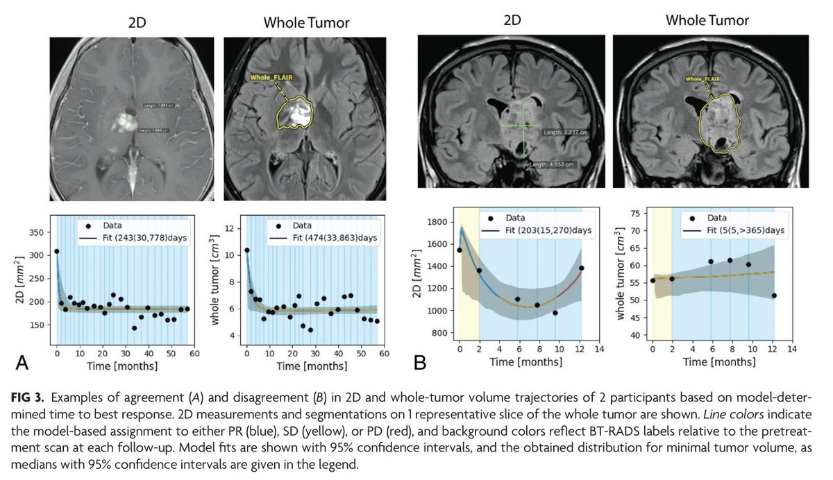 'Comparison of Volumetric and 2D Measurements and Longitudinal Trajectories in the Response Assessment of BRAF V600E-Mutant Pediatric Gliomas in the Pacific Pediatric Neuro-Oncology Consortium Clinical Trial' doi.org/10.3174/ajnr.A… @DivyaRamakris19 @The_ASPNR
