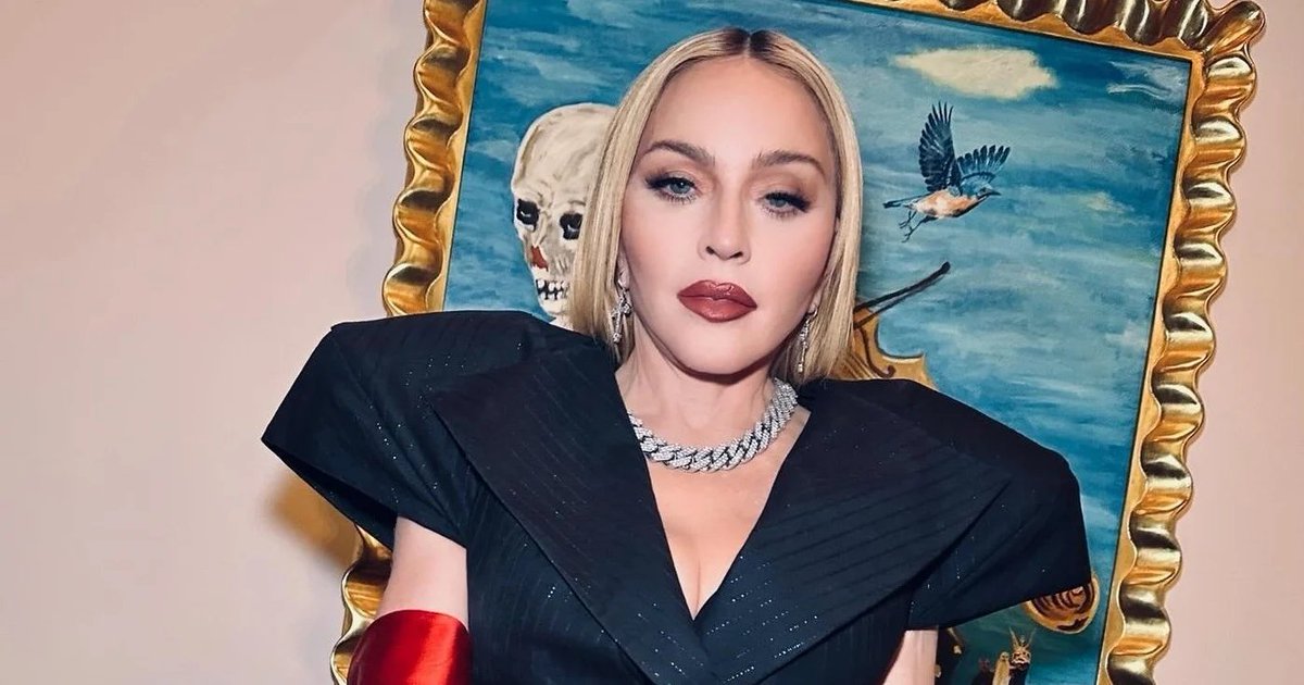 Madonna: evitar totalmente exposição ao sol é mesmo o ideal? [ leia.ag/a/B73C/x1ilwum ] A cantora tem uma máxima desde jovem de não receber raios UV. Ela defende que isso ajudaria na saúde e na pele