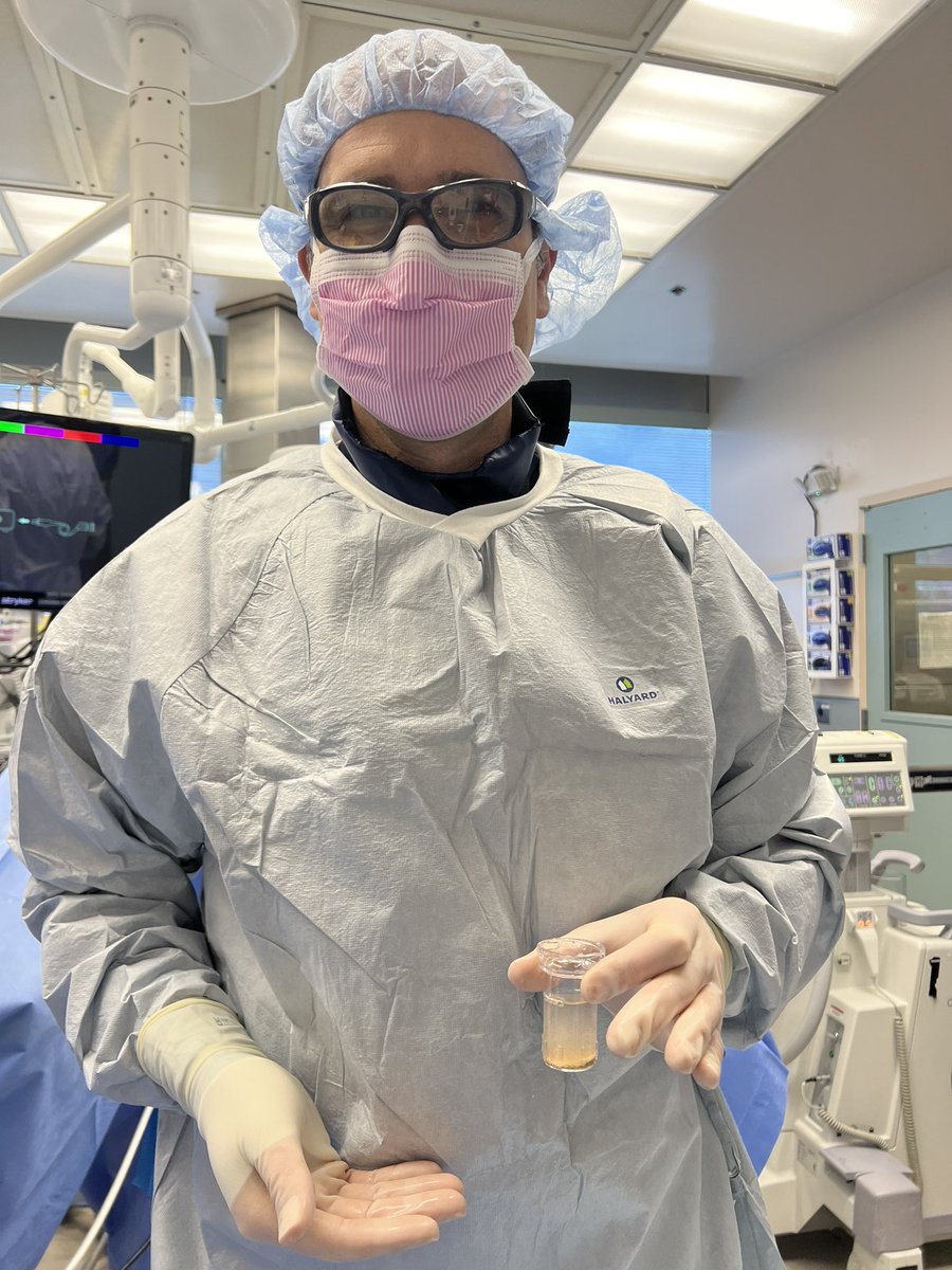 Excited to use the new #CVACSystem for the first time at @UCSD_Urology —when coupled with a good laser technique, this single-use scope vacuums out all the dust under direct visualization. I treated 3 patients each with 2cm stone burden. This is a game changer!