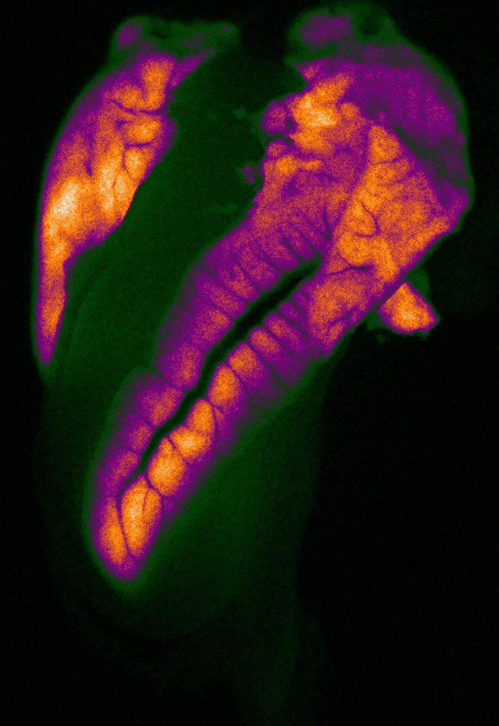 A #Zebrafish #liver lobe, irrigated by hepatic artery and its tributaries.  Image by @selifeski .