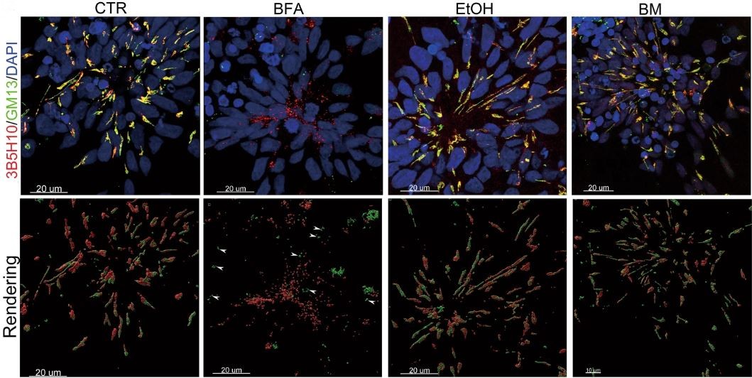 Scientists replicated #corticogenesis in the #Huntington's disease (HD) fetal brain using patient-derived 🧠 cortical #organoids. The organoids had pathological phenotypes, including abnormalities in early HD subcortical projections. @molpsychiatry | go.nature.com/3wg7Xdu