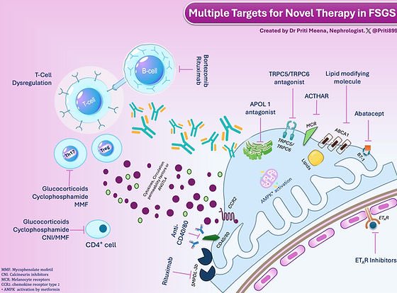 Such a great infographic by @priti899 on therapies in pipeline for FSGS @GlomCon enrollmypatient.org