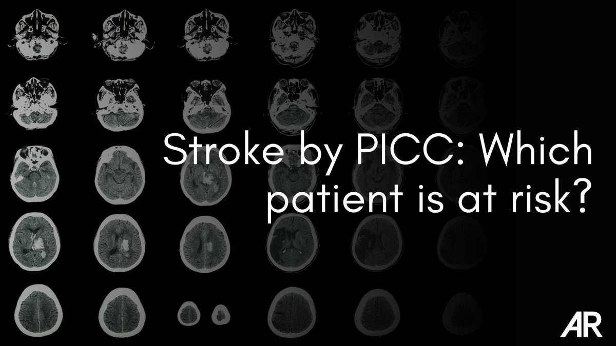 The presence of acute neurologic findings in a patient with a PICC should raise the question of whether the catheter is in the arterial system or in the venous system with a right-to-left shunt.

Read more ➡️ bit.ly/3QsRyt0
#StrokeAwarenessMonth #NeuroImaging #NeuroRad