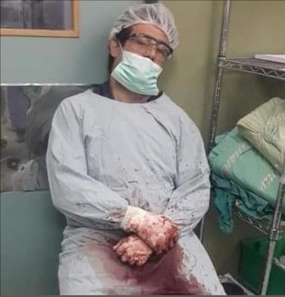 Moriremos de pie, no nos arrodillaremos ...
Y como digo siempre... lo único que queda en el valle son sus piedras... nosotros somos sus piedras.
- Dr. Adnan Al-Barsh 💔

El Dr. Adnan Al-Barsh, jefe de ortopedia del Hospital Al-Shifa, fue declarado muerto después de meses de…