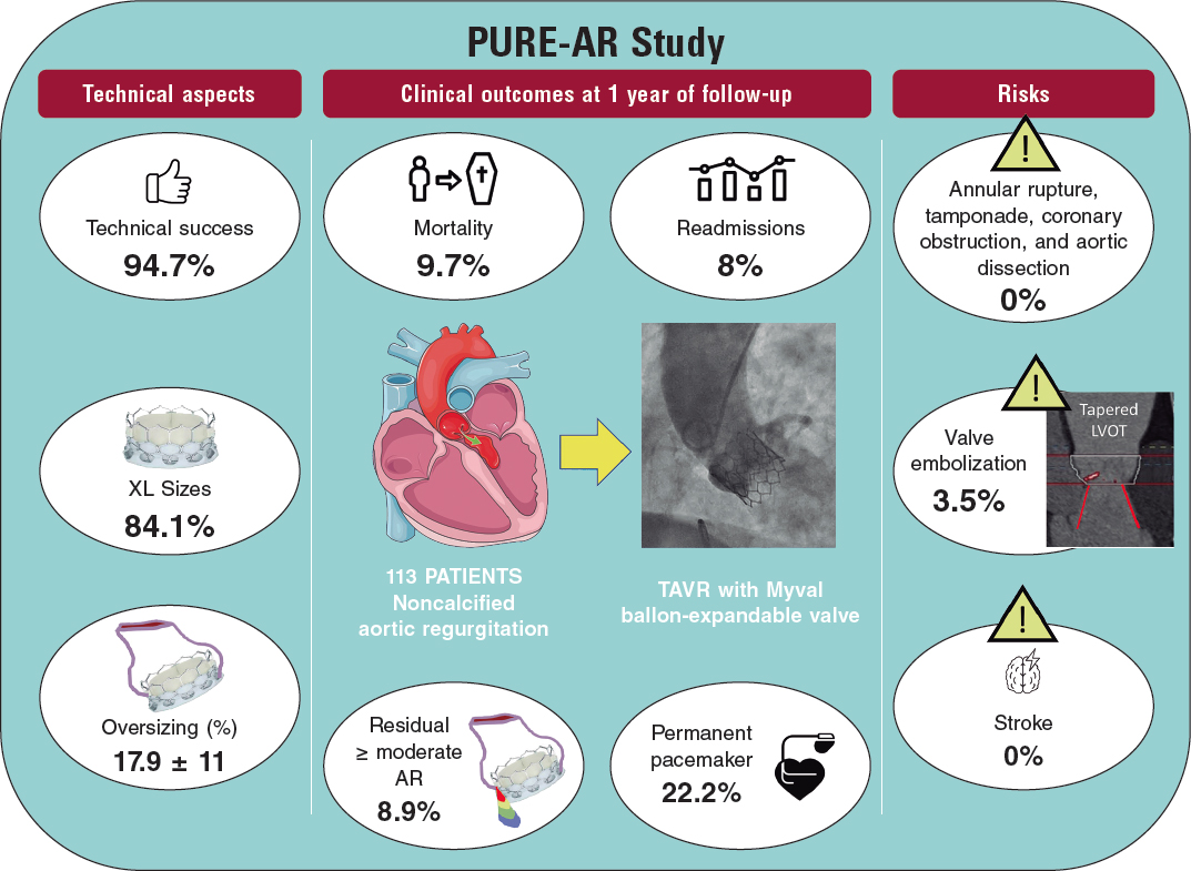 REC Publications (@revespcardiol) on Twitter photo Transcatheter aortic valve replacement for noncalcified aortic regurgitation. Where are we now? #recintervcardiol <a href="/ignamatsant/">Ignacio J. Amat</a> <a href="/jpsanchezluna/">Juan Pablo Sánchez-Luna</a> recintervcardiol.org/en/editorial/t… Transcatheter aortic valve replacement for noncalcified aortic regurgitation. Where are we now? #recintervcardiol <a href="/ignamatsant/">Ignacio J. Amat</a> <a href="/jpsanchezluna/">Juan Pablo Sánchez-Luna</a> recintervcardiol.org/en/editorial/t…