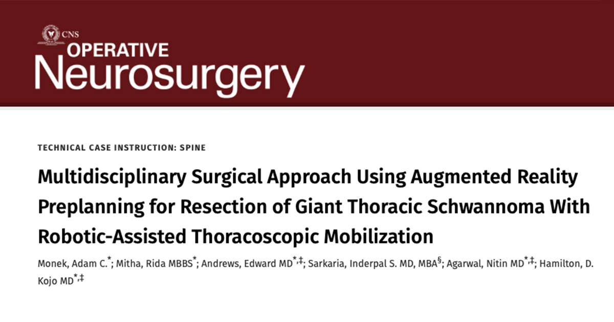 In surgical treatment of large thoracic dumbbell tumors, perioperative evaluation with augmented reality, new robotic surgical techniques, and a dual surgeon approach can mitigate a myriad of risks. journals.lww.com/onsonline/abst… @NitinAgarwalMD @RidaMitha @UPMCPhysicianEd