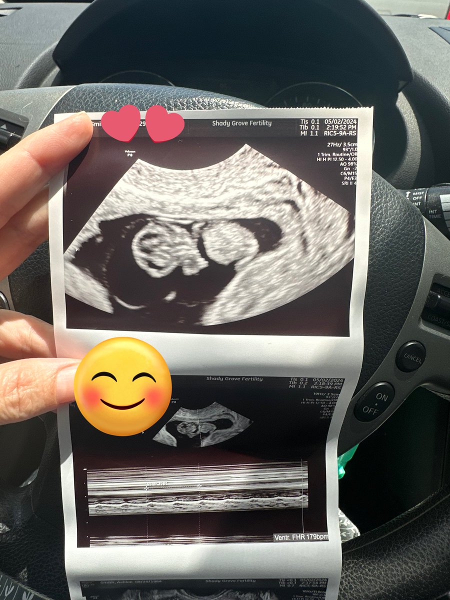 9 weeks and we are officially graduated from the fertility clinic! 

We got to see her arms and legs moving around and I am just so beside myself right now!