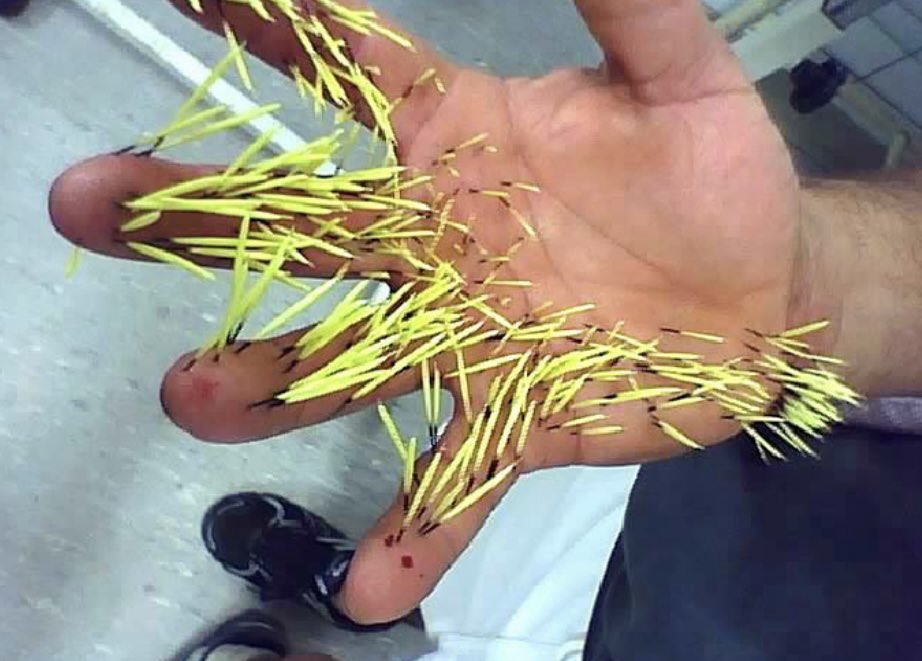 Oren Gottfried, MD tweet media