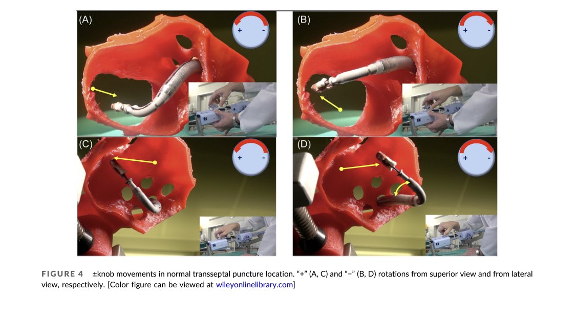 Understand advanced MitraClip knobs movement in different transseptal puncture situations @m_taramasso @drmaisano onlinelibrary.wiley.com/doi/10.1002/cc…