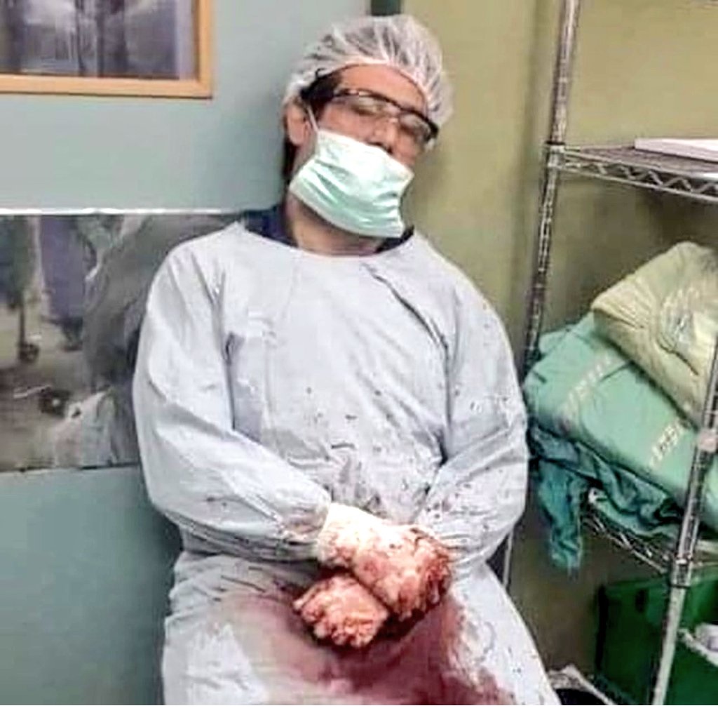 El Şifa Tıp Kompleksi Ortopedi Bölüm Başkanı
Adnan El Burş
bir günde 28 ameliyat gerçekleştirdikten sonra bu fotoğrafla ünlü oldu
Bugün İsrail hapishanesinde işkence altında öldü
Hastaneleri yıkmak ve doktorları öldürmek
İsrail için bir nefsi müdafaa biçimidir