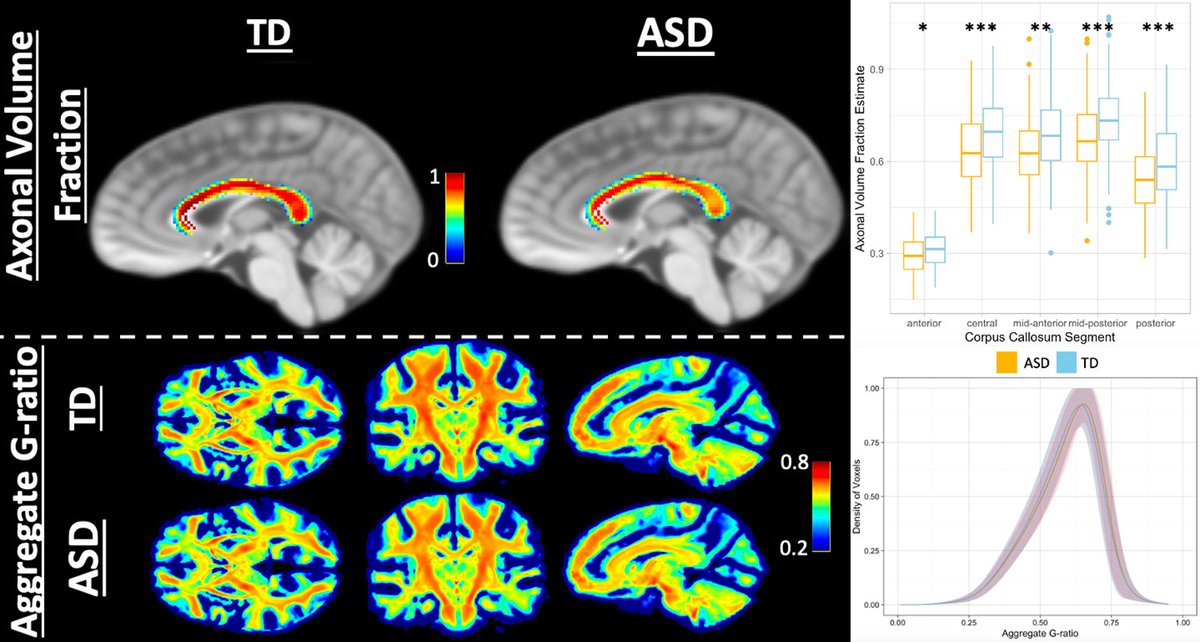 Conduction velocity, G-ratio, and extracellular water as microstructural characteristics of autism spectrum disor dx.plos.org/10.1371/journa…