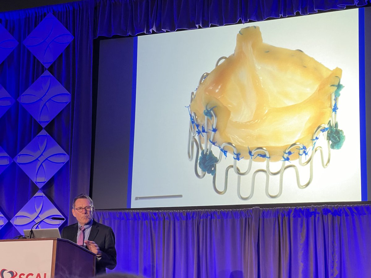 The “first” transcatheter aortic valve homemade by Dr. Andersen using a wire from his cardiac surgery colleagues and a pig valve from his local butcher shop #SCAI2024