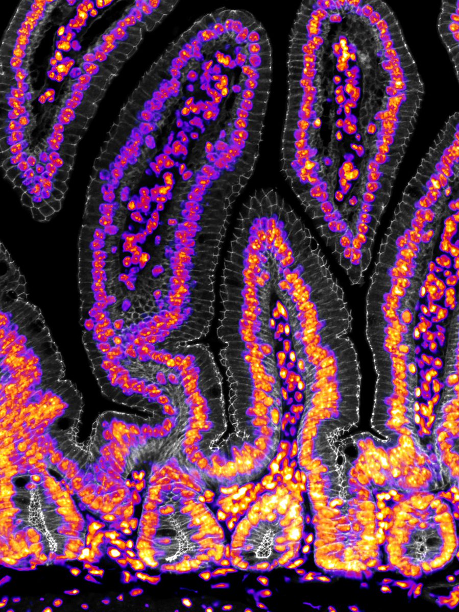 AmyEngevik's tweet image. Trying out some new antibodies and this one is so pretty...

#tightjunctions #bioart #sciart #histoart #pathart #microscopy #intestine