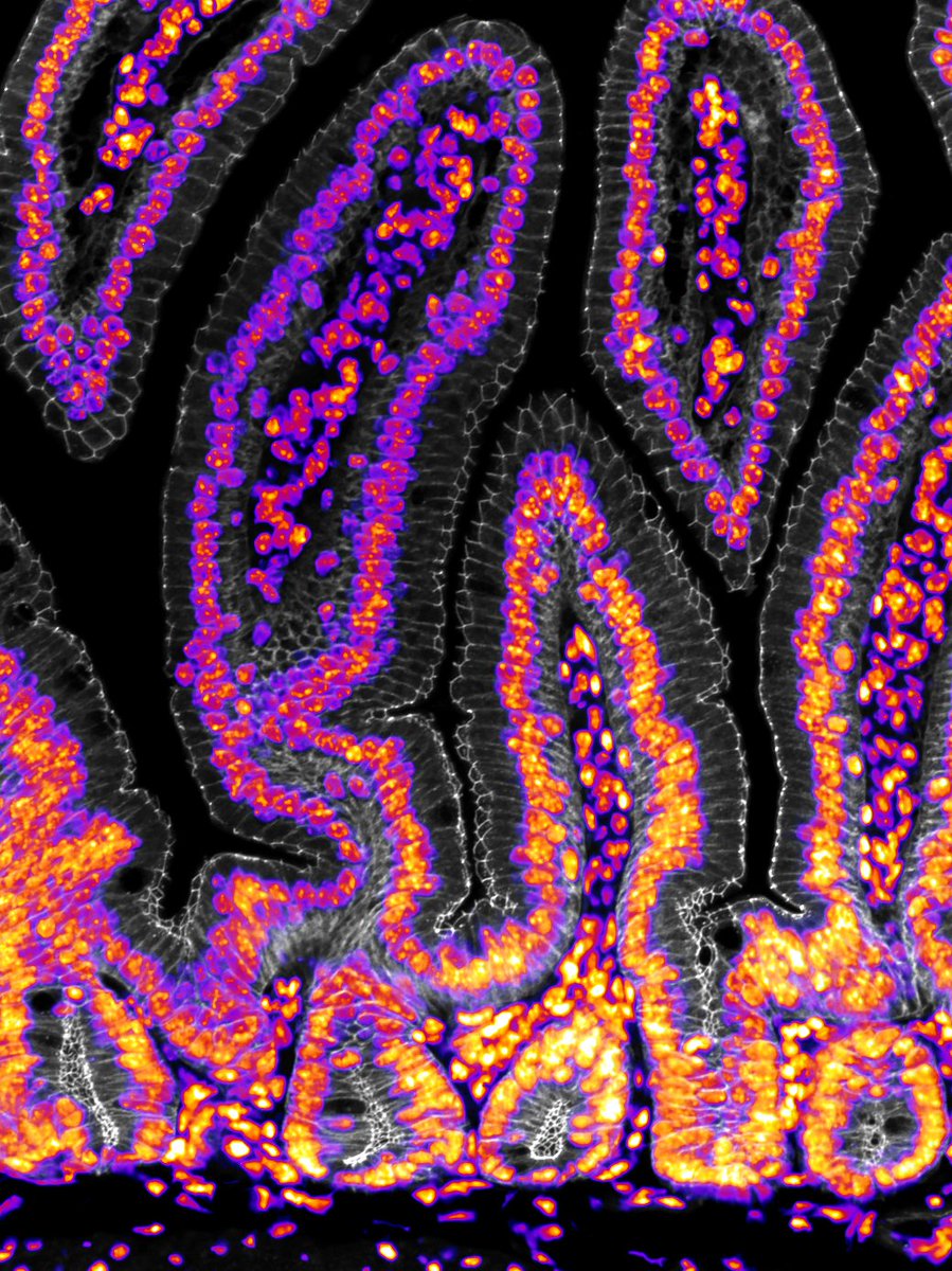 Trying out some new antibodies and this one is so pretty...

#tightjunctions #bioart #sciart #histoart #pathart #microscopy #intestine