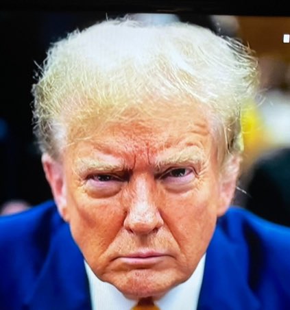 What is happening to Trump’s eyes?