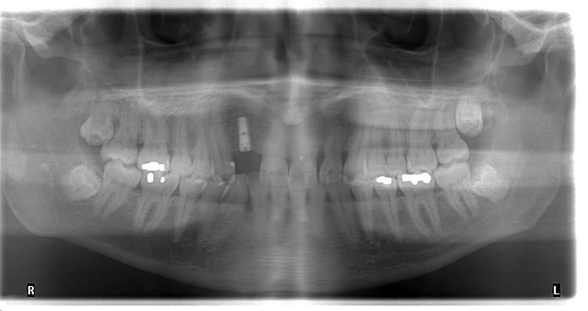 David F. Prenatt, Jr tweet media