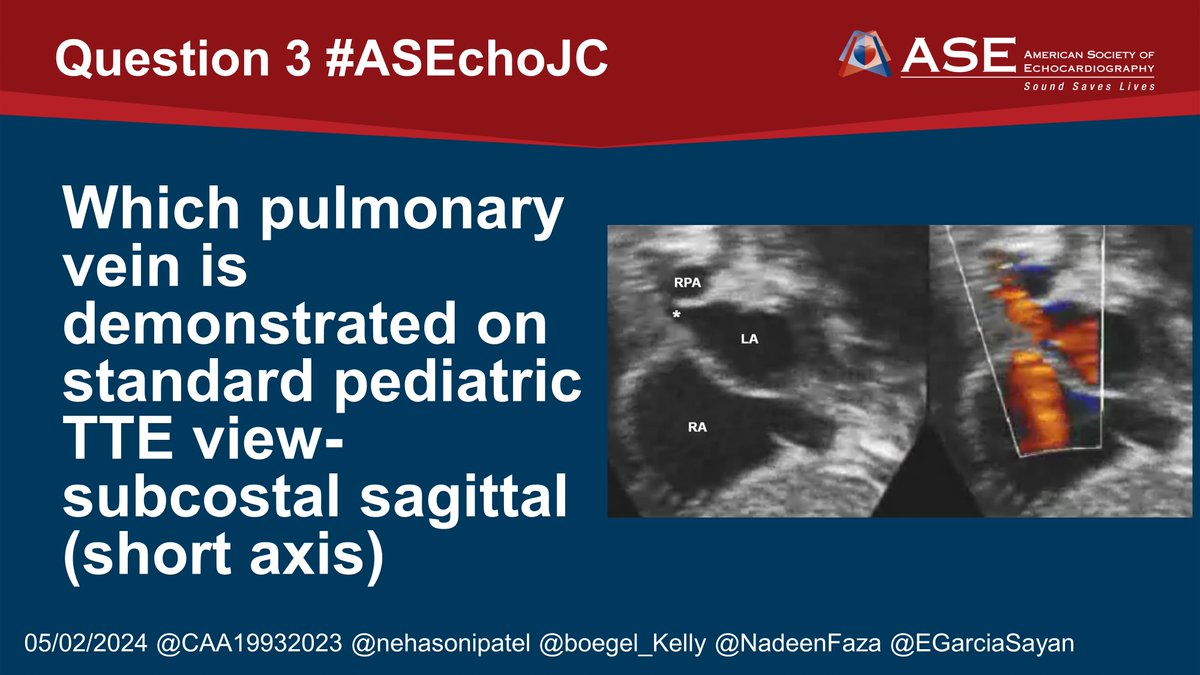 Enrique Garcia-Sayan, MD, FACC, FASE (@egarciasayan) on Twitter photo 📢Question 3 #ASEchoJC: Which pulmonary vein is demonstrated on standard pediatric TTE view- subcostal sagittal (short axis)
<a href="/ASE360/">American Society of Echocardiography</a> <a href="/CAA19932023/">CarrieAltman</a> <a href="/nehasonipatel/">Neha</a> @boegel_Kelly <a href="/NadeenFaza/">Nadeen N. Faza, M.D.</a> 📢Question 3 #ASEchoJC: Which pulmonary vein is demonstrated on standard pediatric TTE view- subcostal sagittal (short axis)
<a href="/ASE360/">American Society of Echocardiography</a> <a href="/CAA19932023/">CarrieAltman</a> <a href="/nehasonipatel/">Neha</a> @boegel_Kelly <a href="/NadeenFaza/">Nadeen N. Faza, M.D.</a>