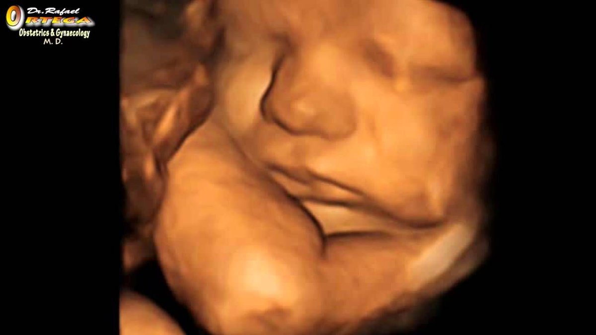 New Pro-Life Laws are Teaching Students About Fetal Development buff.ly/4aX88d5