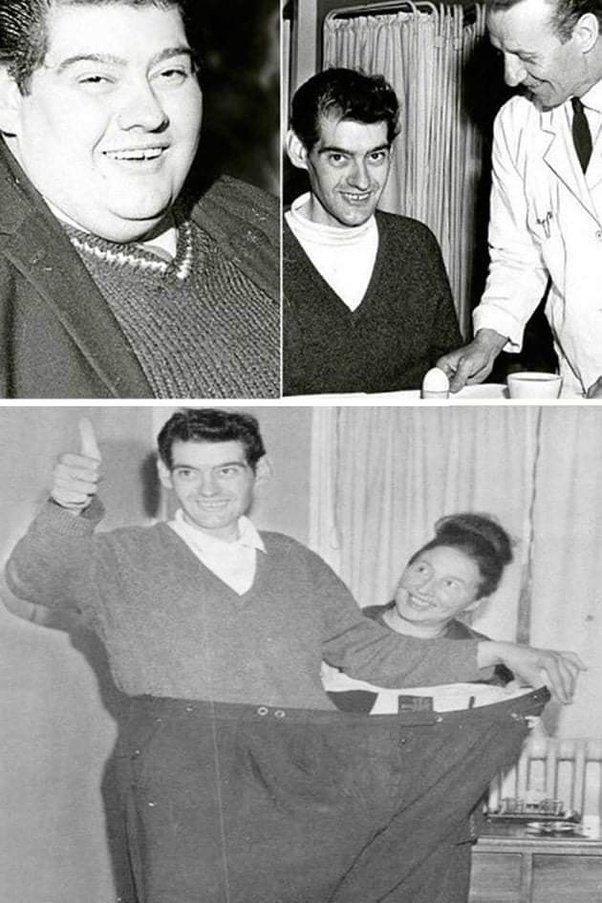 A Scotsman In 1965 Angus Barbieri from Tayport a morbidly obese man did not eat food for 382 Days
He was 32.5st & wanted to do an experimental fast.
He ingested only tea, coffee, sparkling water & vitamins
He ended up losing 19.5st
Barbieri's fast is recognized as a world record