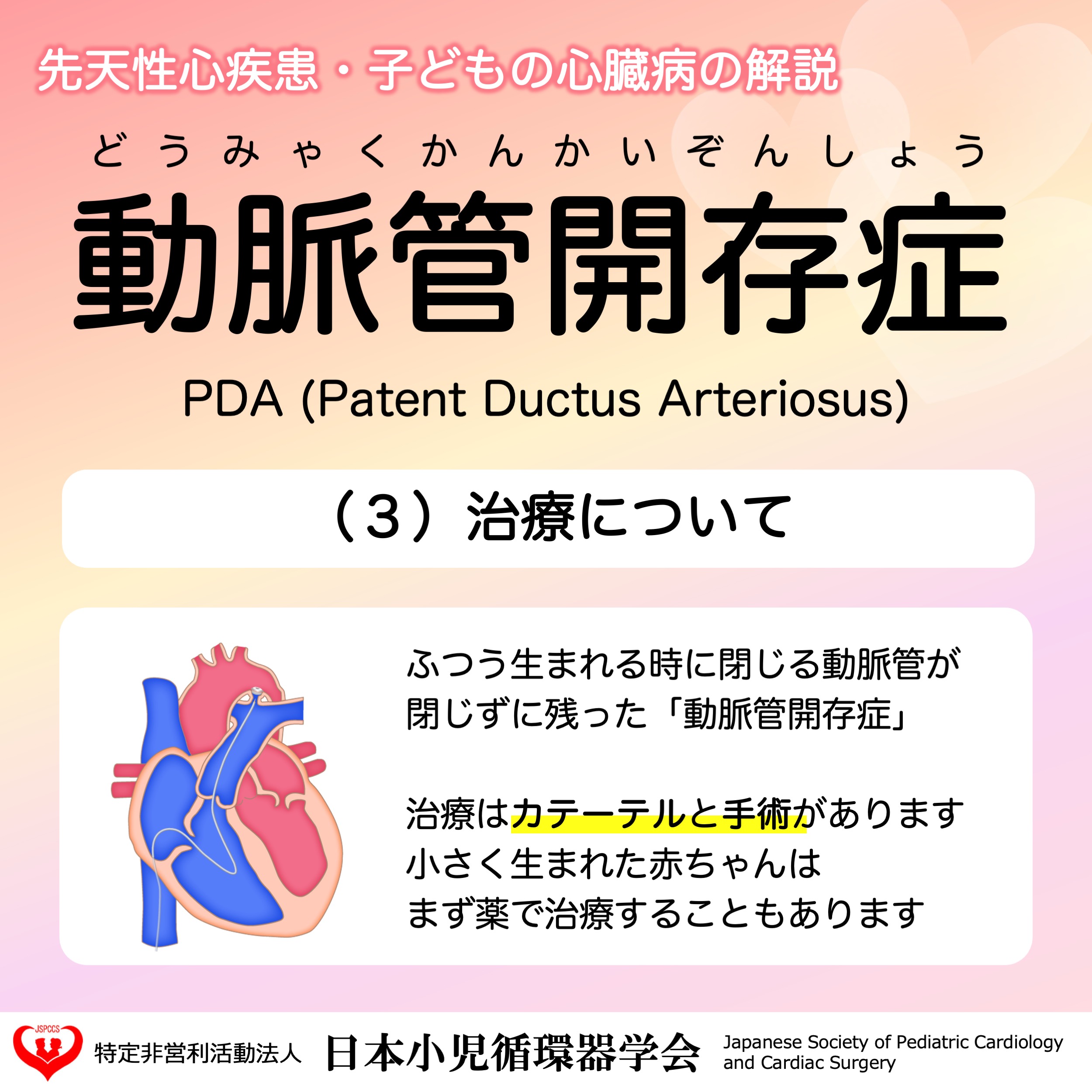日本小児循環器学会【公式】 on X: 