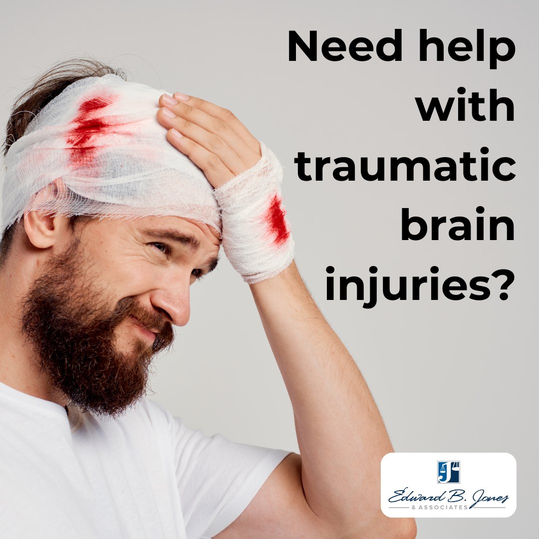 We're here to help! Our experienced team specializes in advocating for those affected by TBIs, ensuring they get the compensation and support they need. Need help? Contact us: (985) 399-5944 #TraumaticBrainInjury #TBI #LegalSupport #EdwardBJonesLaw